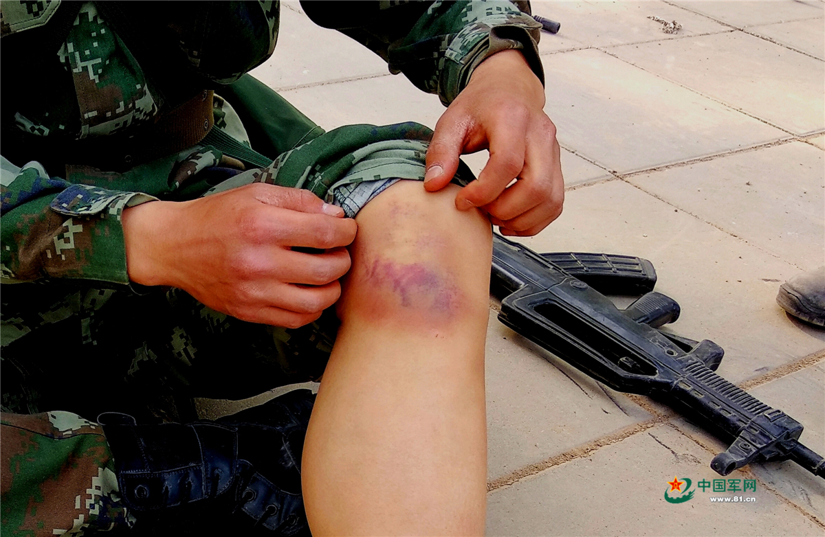 这些伤疤是军人最美的"军功章",你被哪枚感动到? - 中国军网