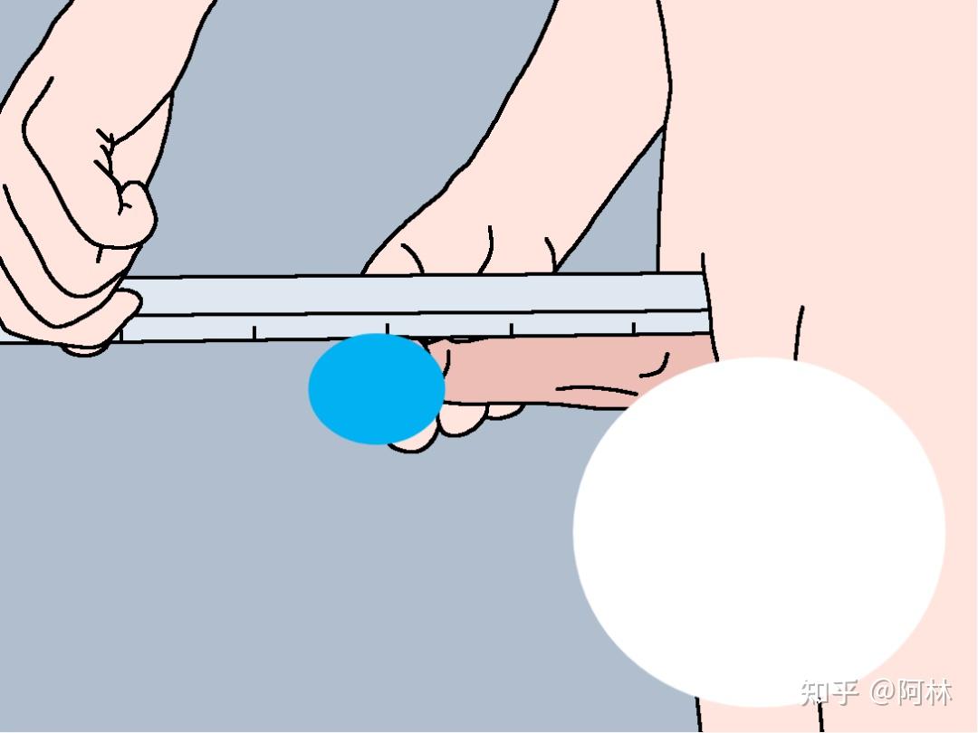 包茎者,尽量将包皮后推再牵拉龟头),量尺平行于丁丁背侧,测量丁丁夹角