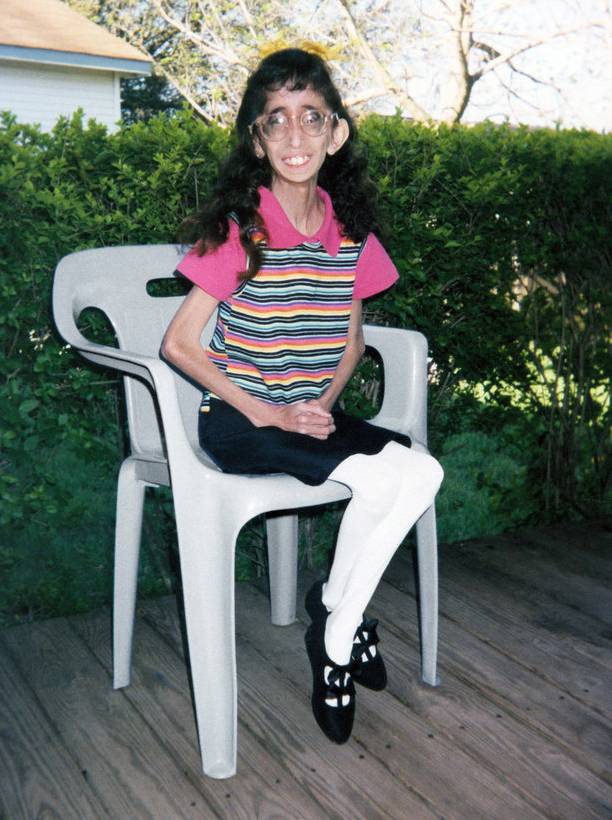 相当于一个8岁的小女孩她的体重却一直维持在26公斤左右尽管一天要吃