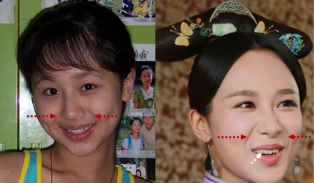 坦白讲杨紫的颜值不论前后如何变化,都称不上大美人,很多人也依旧get