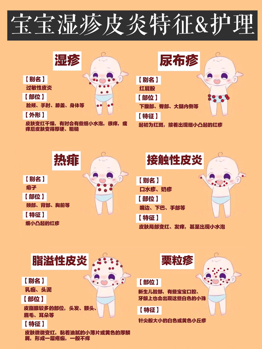 宝宝湿疹热疹痱子如何分辨71新生儿如何护理71