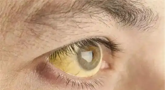 想肝好:少2甜,多3水,肝或慢慢变健康