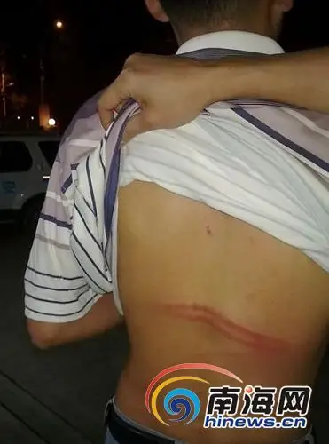 三亞城管圍毆遊客續:打人者道歉 警方立案調查