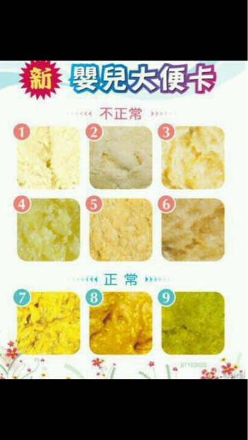 这样颜色得大便正常吗,是陶土色吗,我一个才一次母乳,基本奶粉