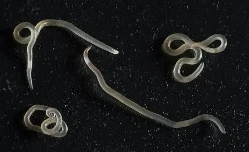 三文鱼之异尖线虫