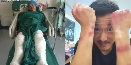 吴京晒图入院,疑似膝盖受伤,做一名合格武打巨星不容易_画面_电影界