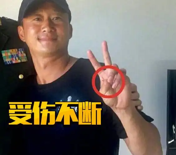 吴京见医生比见老婆谢楠频繁你只知道他断指其实他全身是伤