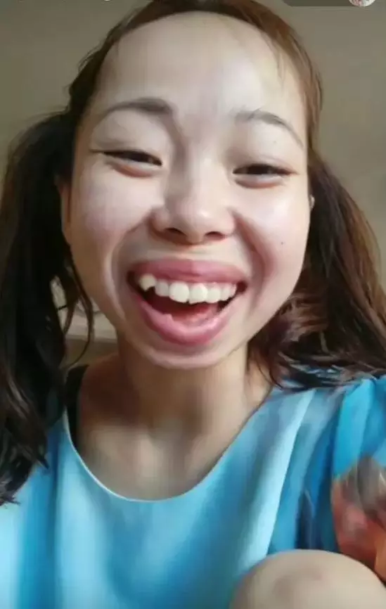 这个网红一夜爆红却因为丑被封杀了