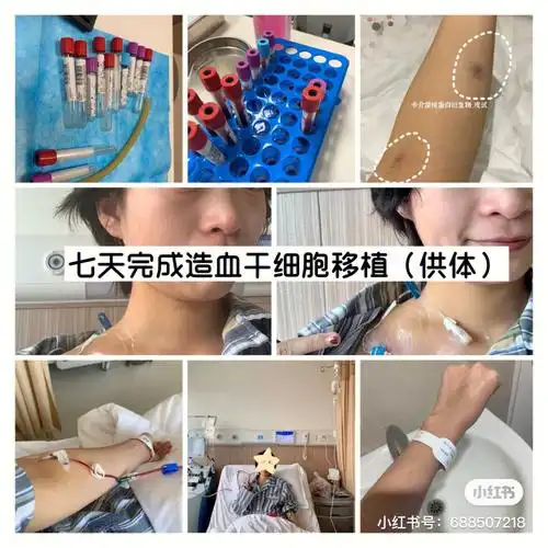 七天完成造血干细胞移植(供体)三