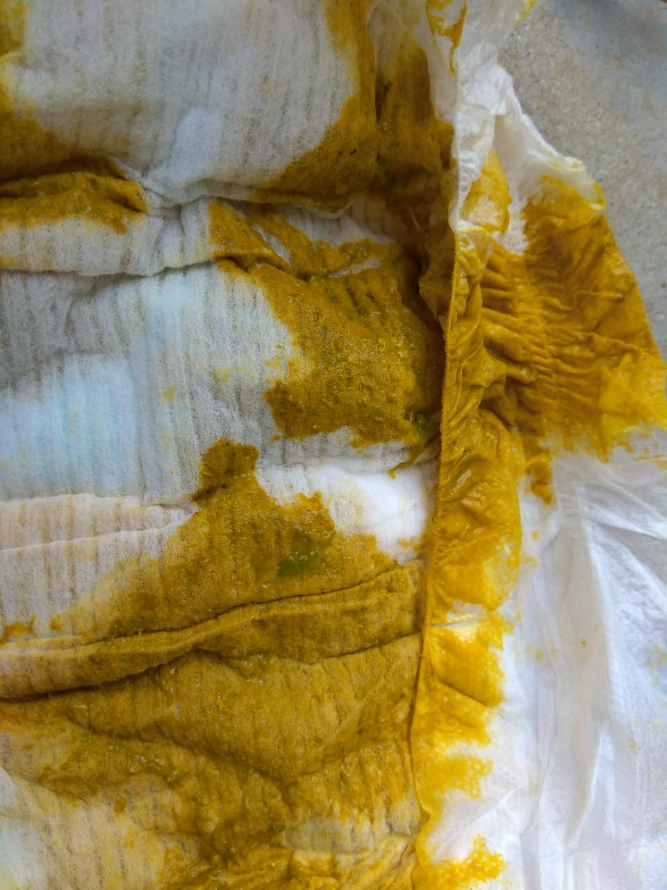 问题,吃奶睡觉也没有问题 为您推荐: 其他回答 如果宝宝的大便呈稀水