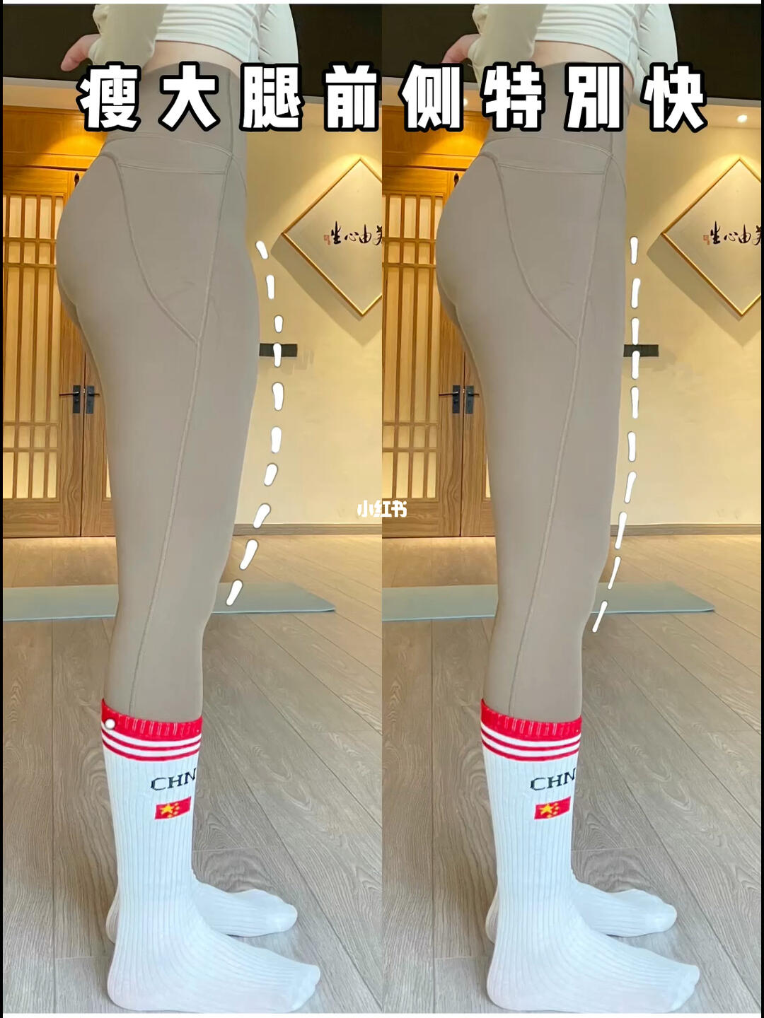 大腿前侧突出怎么减059cm的变化实实在在