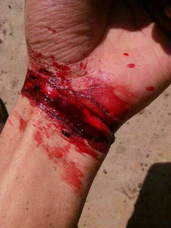 朋友在外地,发了个割腕的图后联系不上了.请帮忙看下是不是真的割腕.