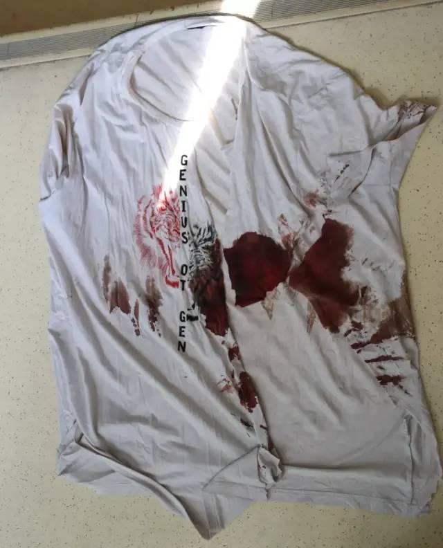 沾满鲜血的上衣