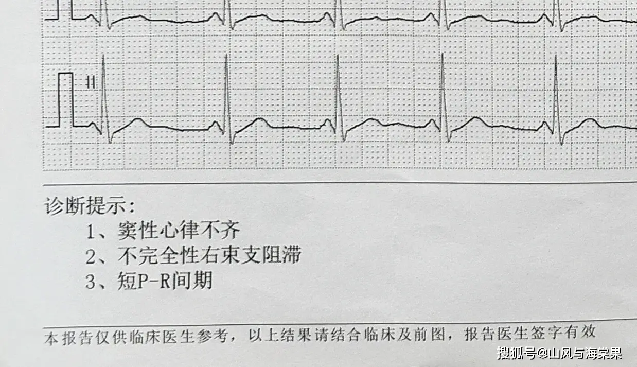 当智能手表成为健康管理神器didoe10血压心电智能手表