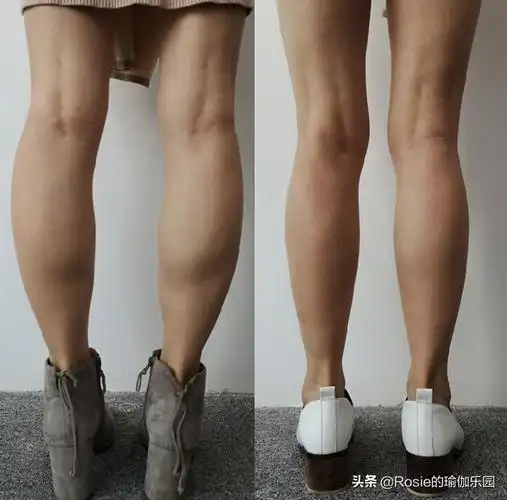 内八字腿型走路视频,小腿并不拢像括号-八字-荣耀易学