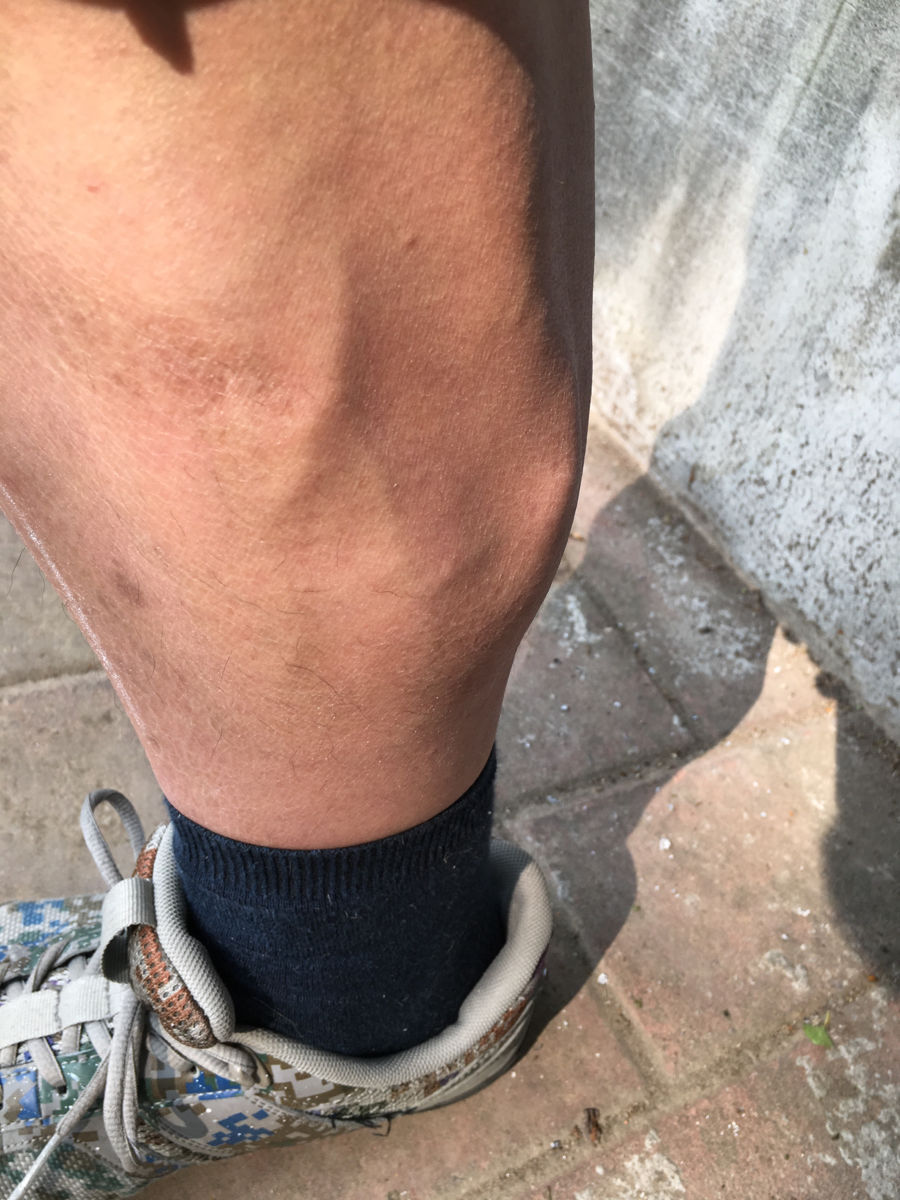 男生小腿肌肉超壮是什么体验?