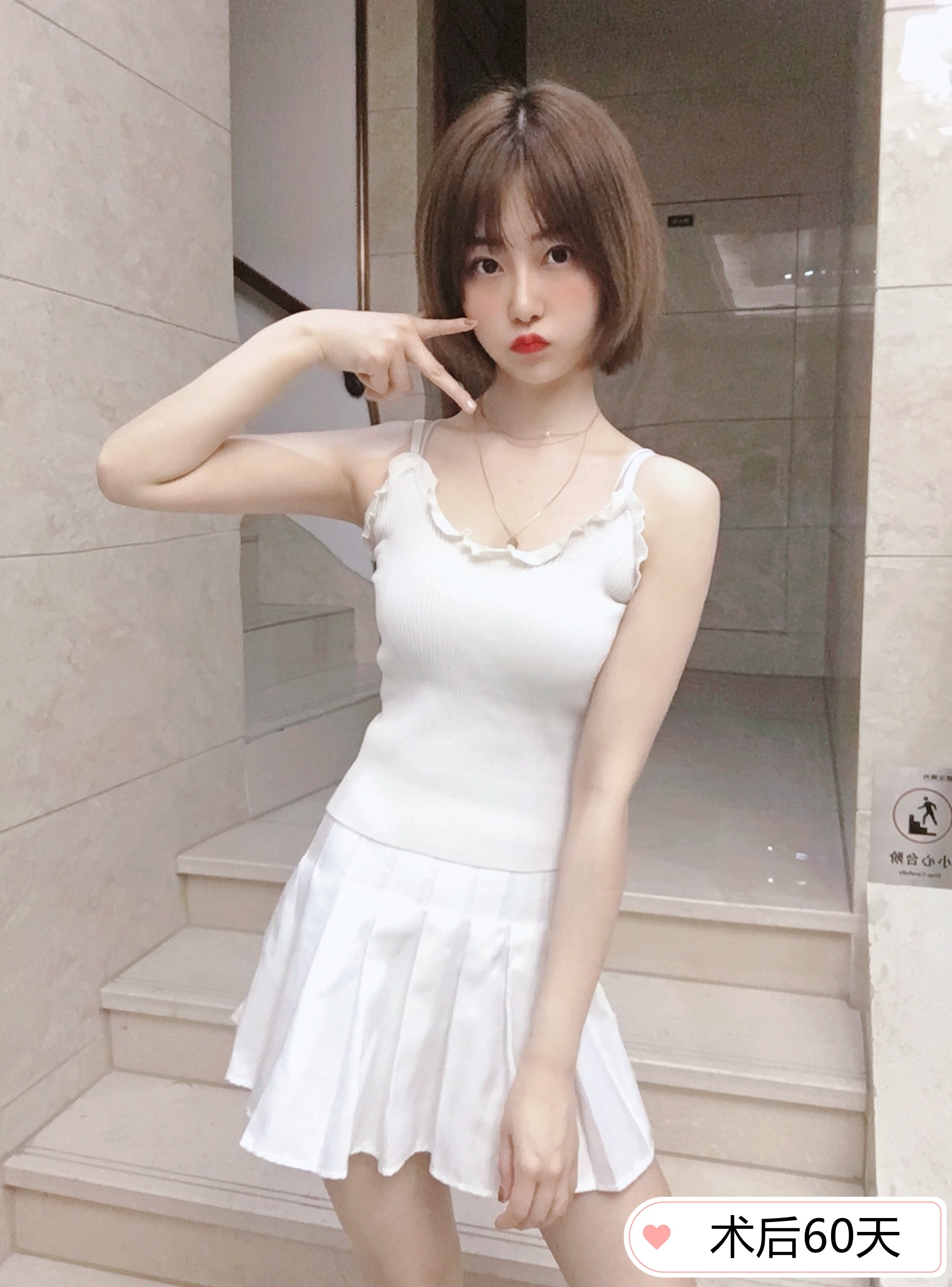 手臂吸脂—轻松拥有天鹅臂!