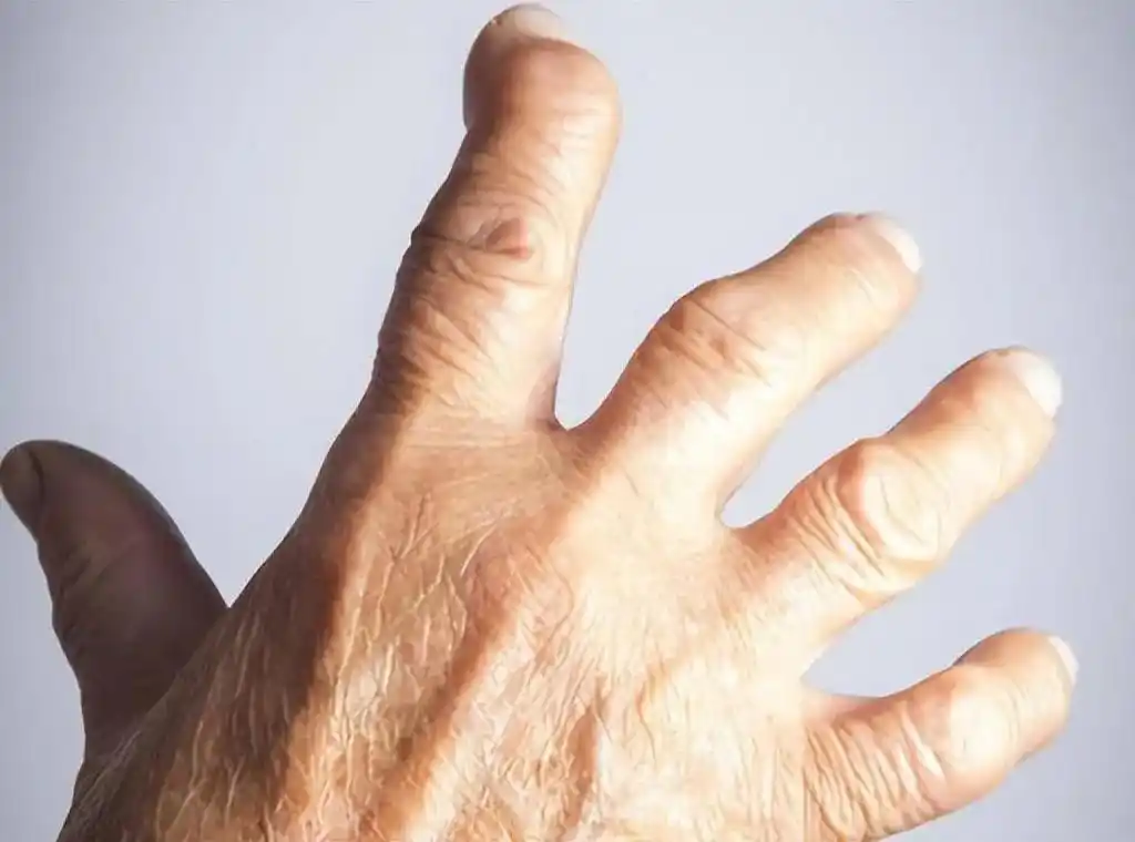 如果是手肘,手腕,指关节 - 抖音