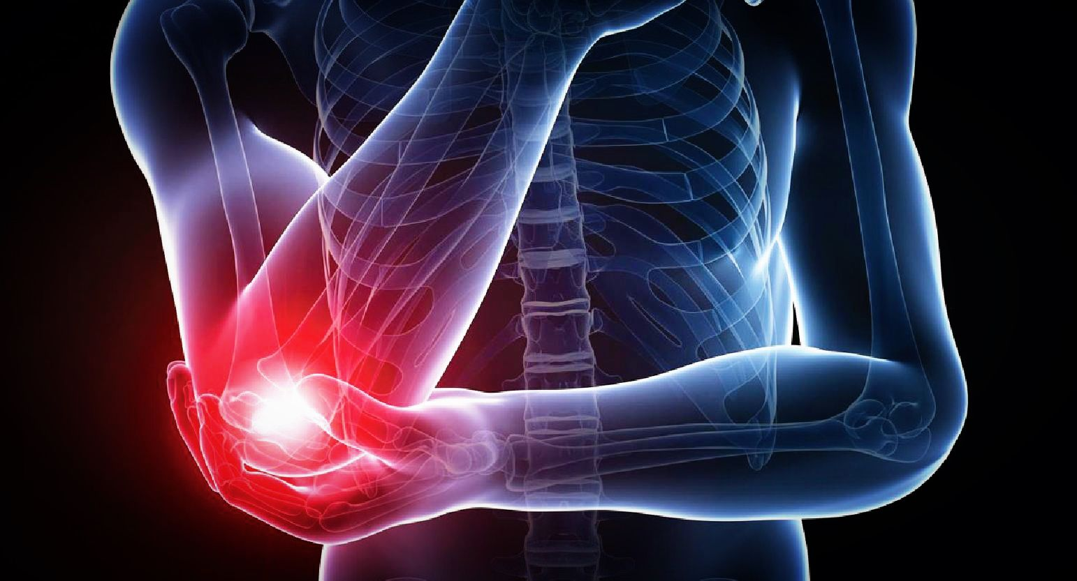 胳膊肘疼是怎么回事(手不能握,胳膊肘外侧疼痛是怎么回事?