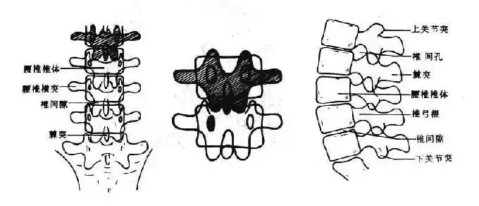 腰椎椎弓板示意图