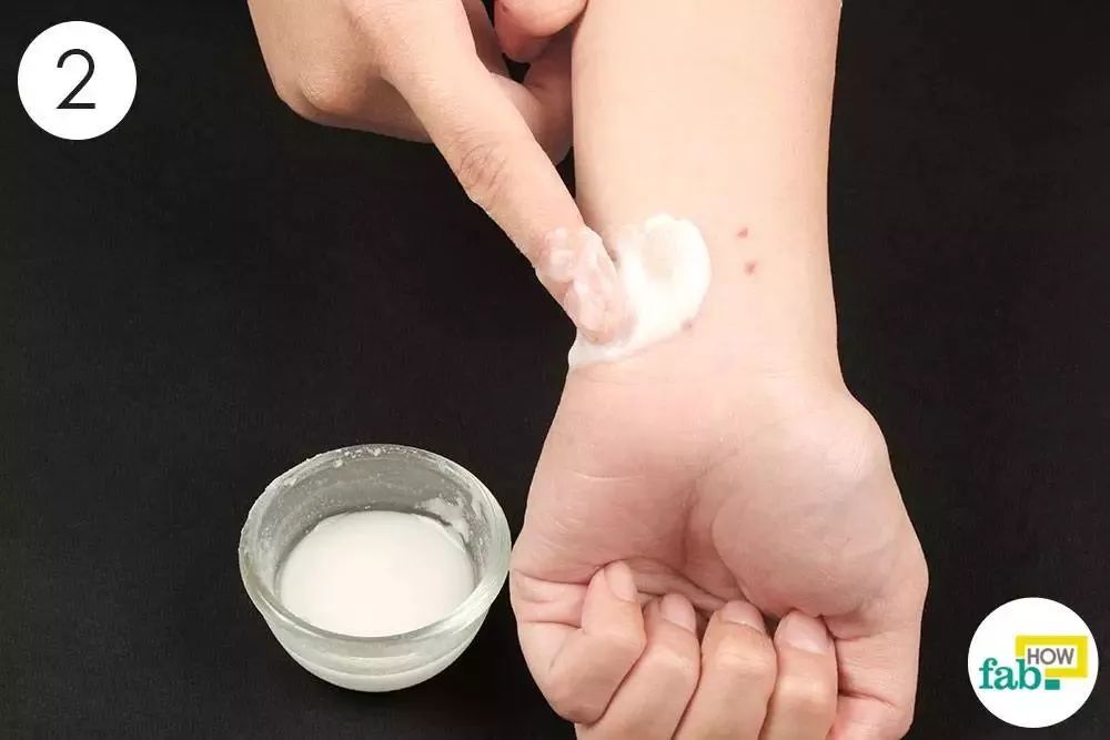 蚊子咬了别擦药涂点这个马上止痒还不花一分钱