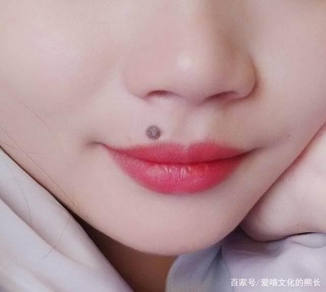 嘴唇长痣的人是有福的,请不要把它取了