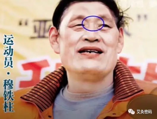 这道鼻褶心征就已经出现了穆铁柱,早在他还是运动员的时候而是已经