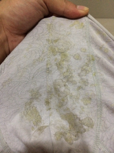 6岁小女孩得了妇科病!许多宝妈都忽视了