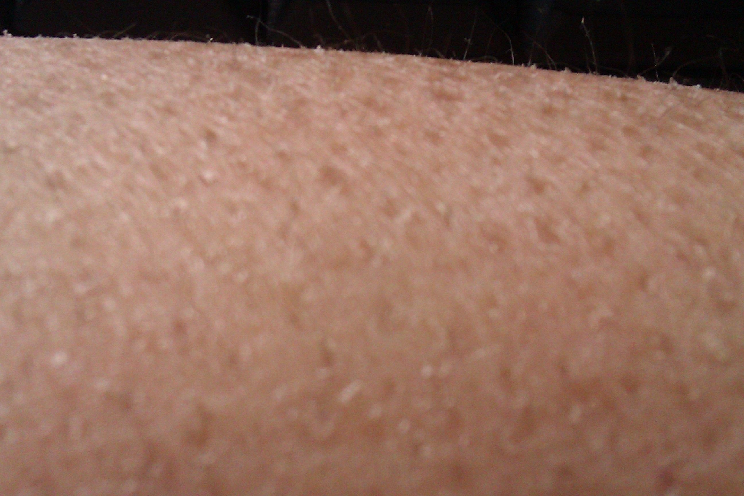 身上有好多皮屑,像鱼鳞一样,一搓就到处飞,皮肤佷干燥