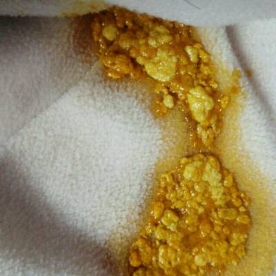 宝宝才九天,总拉这样的奶瓣,要不要紧啊