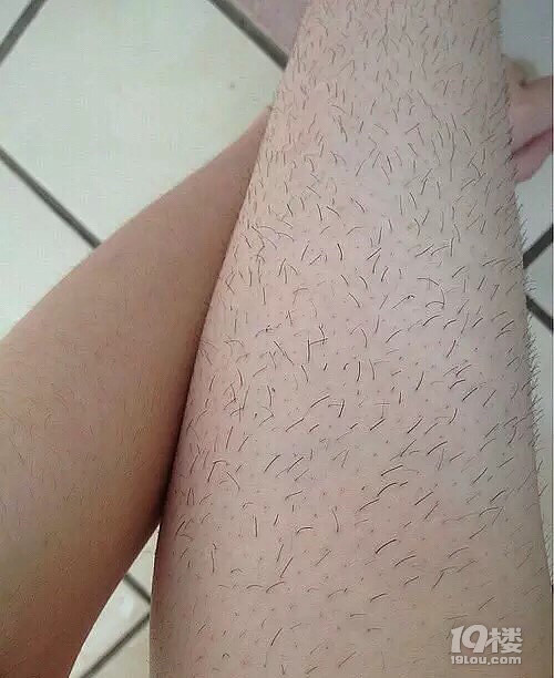 前方高能刮了十年腿毛结果腿上全是毛我可是女生啊